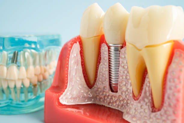 Our Range of Dental Services in Mason, MI